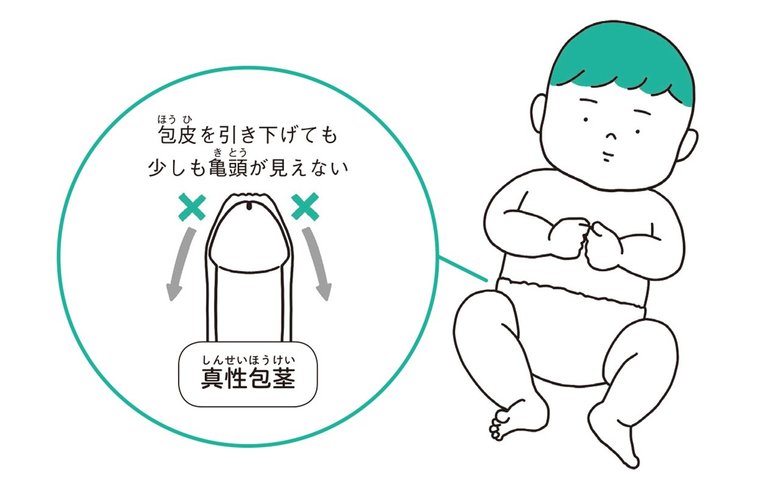新生児の男の子の100％が真性包茎　イラスト／こしいみほ　『おちんちんの教科書』（誠文堂新光社）より