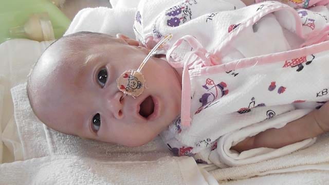 生後100日頃の陽華ちゃん