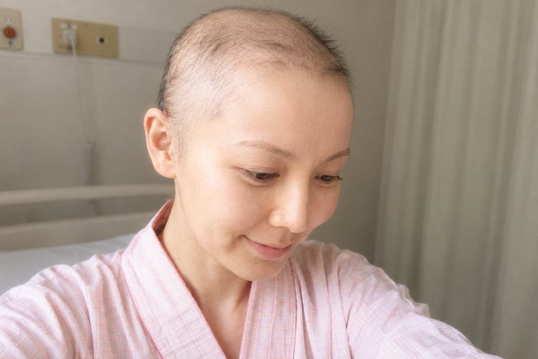 抗がん剤治療により脱毛したとき