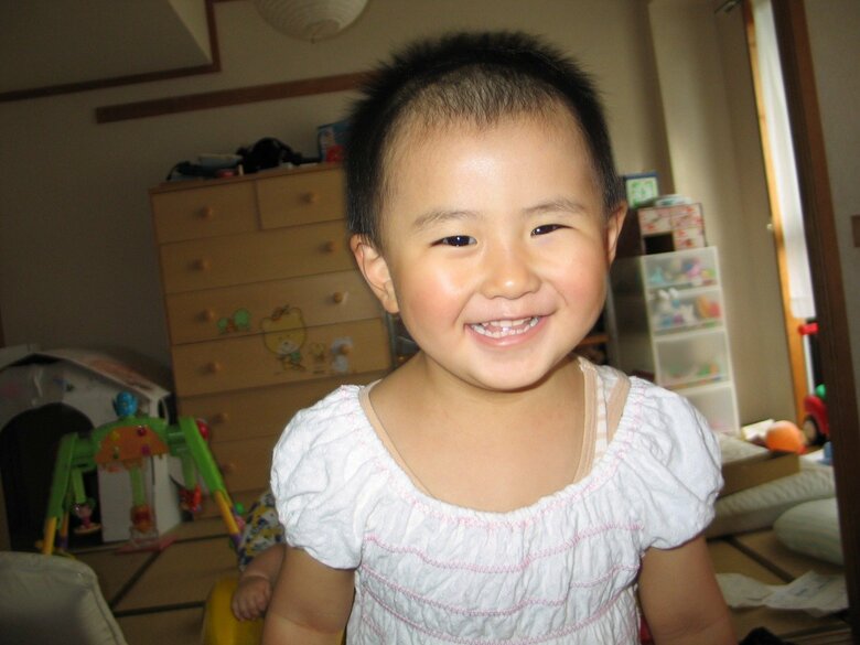 黒目の義眼を初めてつけたとき