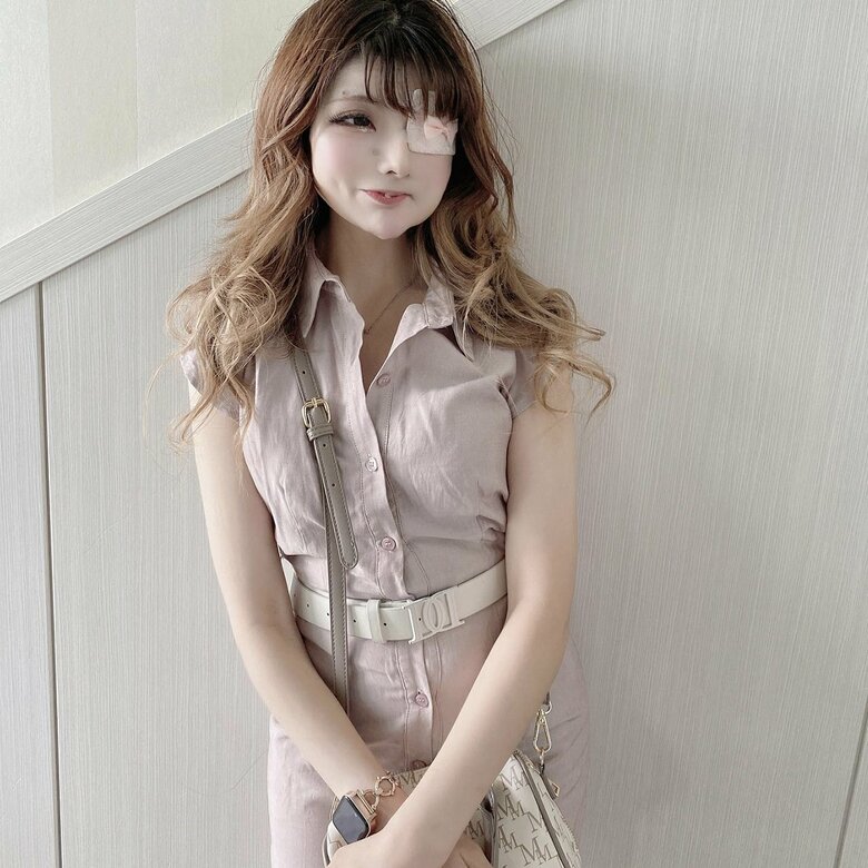 その日の服装に合わせて眼帯を選ぶそう