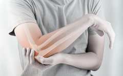 30代から考えたい骨の健康「骨密度の維持」が鍵に【専門医に聞く】