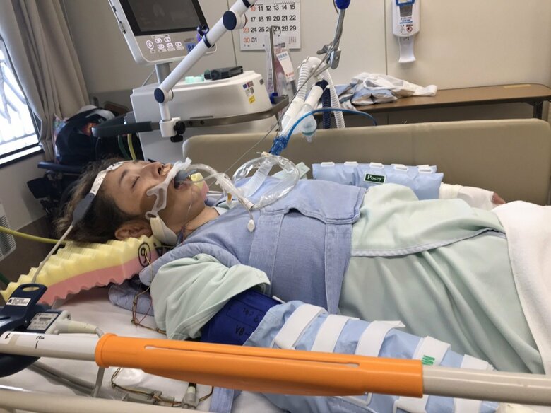 2020年にSLEが再燃して意識不明に