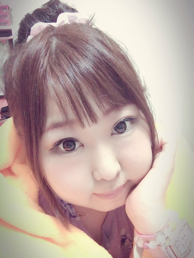 難病の治療に使ったステロイドの副作用でムーンフェイスに