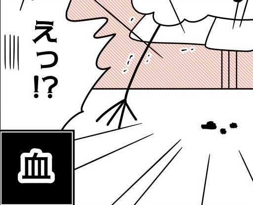 「脱毛しようとして股間が裂けた話」（15/40枚）