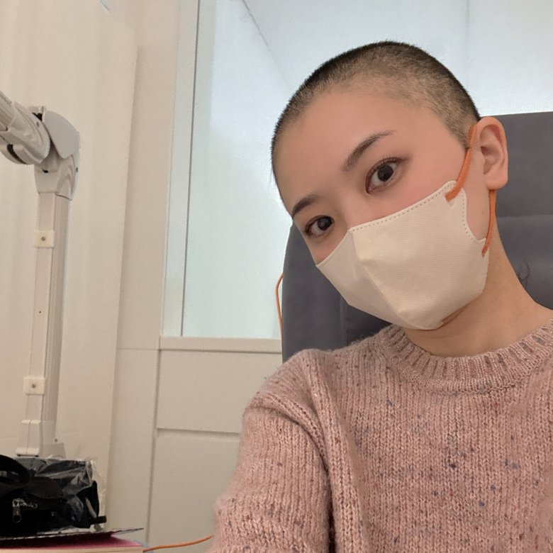 髪の毛が少し生えてきた徳留さん