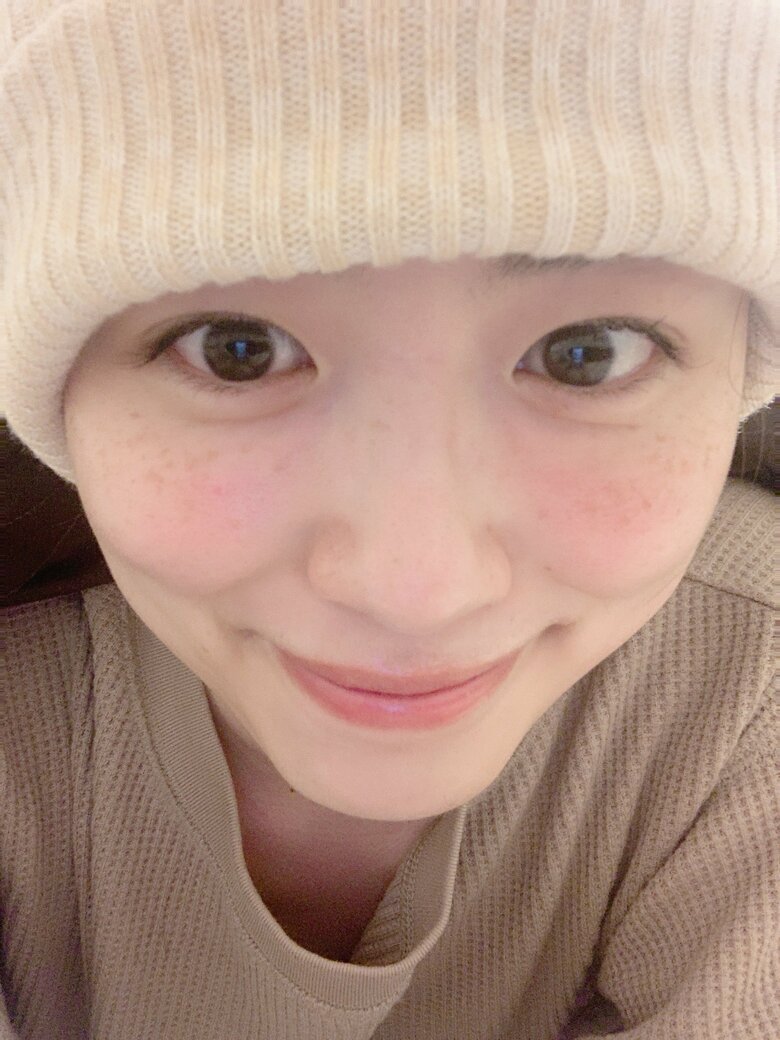 抗がん剤治療中の長藤さん