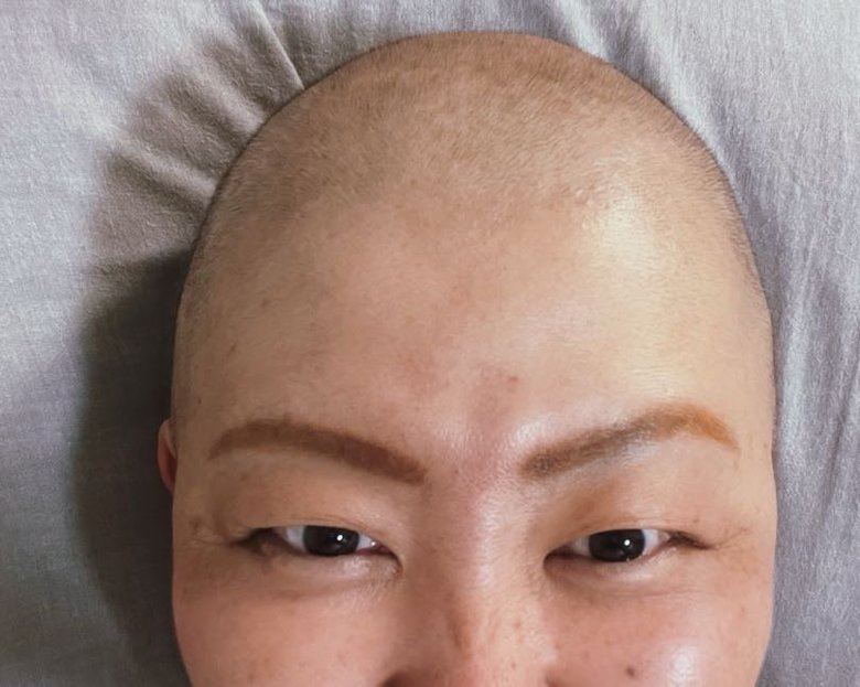 髪の毛が生え始めたころ