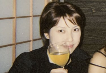 「ウィッグにかけたお金は車数台分」6歳から抜毛症の女性が“ありのまま”を決意した瞬間