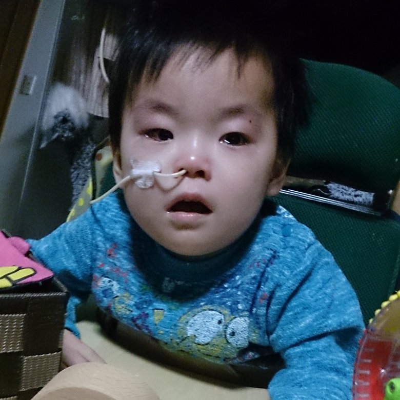 2歳頃からは、鼻から管を通して栄養剤を送る経鼻経管栄養に移行。指導を受け、毎日3食、必死に行った