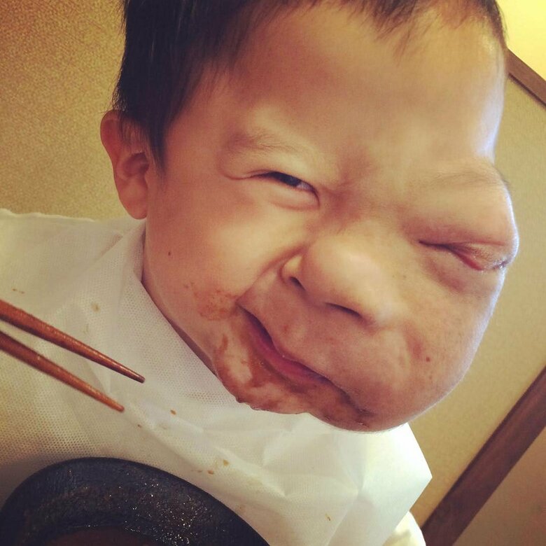 6歳の頃、顔の腫瘍の手術をする前にラーメンを食べたとき