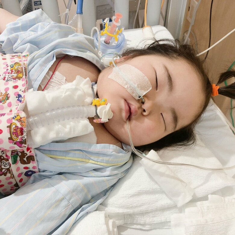 3歳半、急変後に一般病棟に移ったころ。むくみもありピクリとも動かなかった