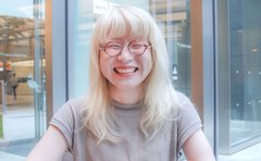 「神秘的なイメージが重圧に」白い肌と髪のアルビノ女性「私は恋愛も結婚も選ばれない」境地から前を向けた「言葉」