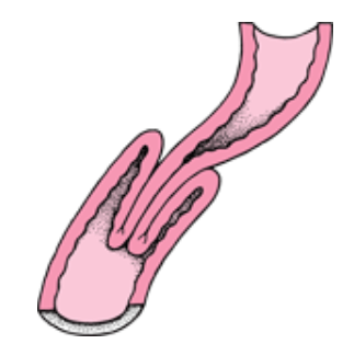 引用：MSDマニュアル