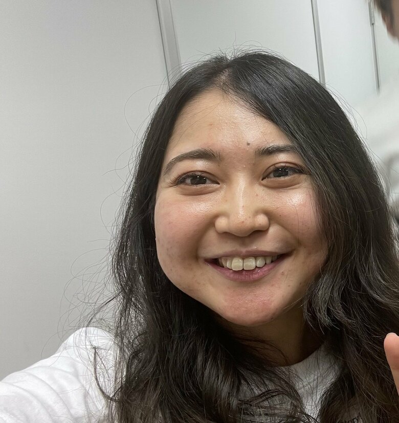 眠れないため、肌あれも目立っていた