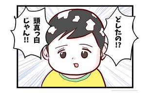 幼い我が子の頭中に白い粉…いったい何やった!?