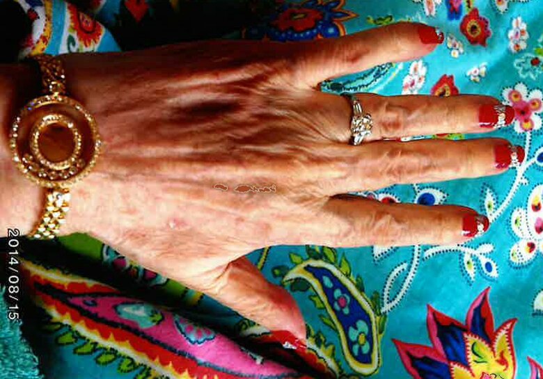 介護中は藤さんがお母さんにネイルを施し気分をアップ！