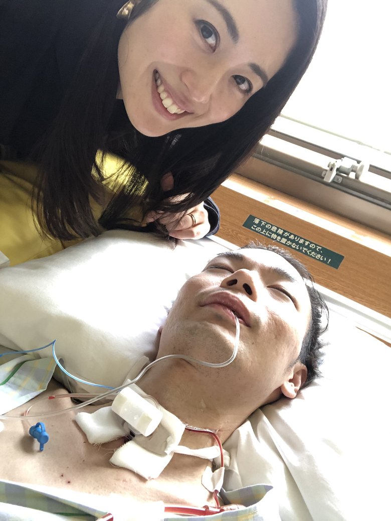 呼吸器をつける手術後の様子