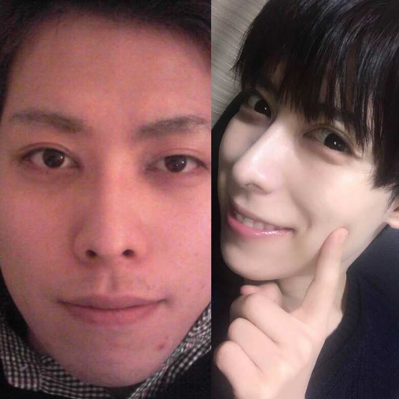 左）美容研究家になる前のフミィさんの肌荒れ時代