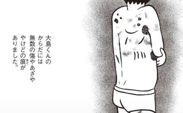 歌川さんが一時身をおいていた施設の問題児・大島くんの体には無数の傷があった／『新版 母さんがどんなに僕を嫌いでも』より（C）Taiji Utagawa/KADOKAWA