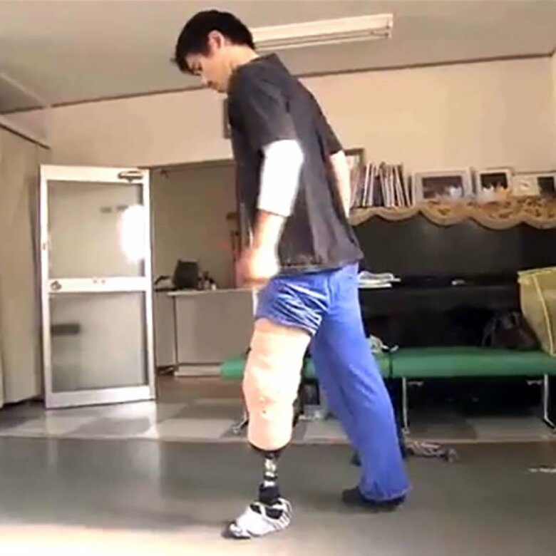 初めて義足をつけたときは違和感だらけだった