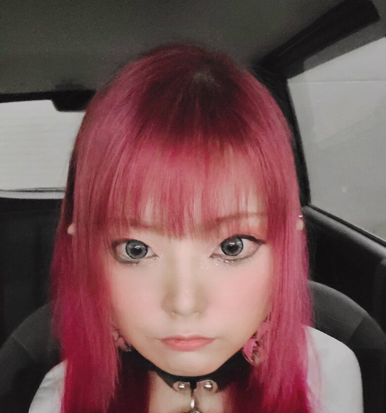 30歳ころ、拒食症で痩せていたころ