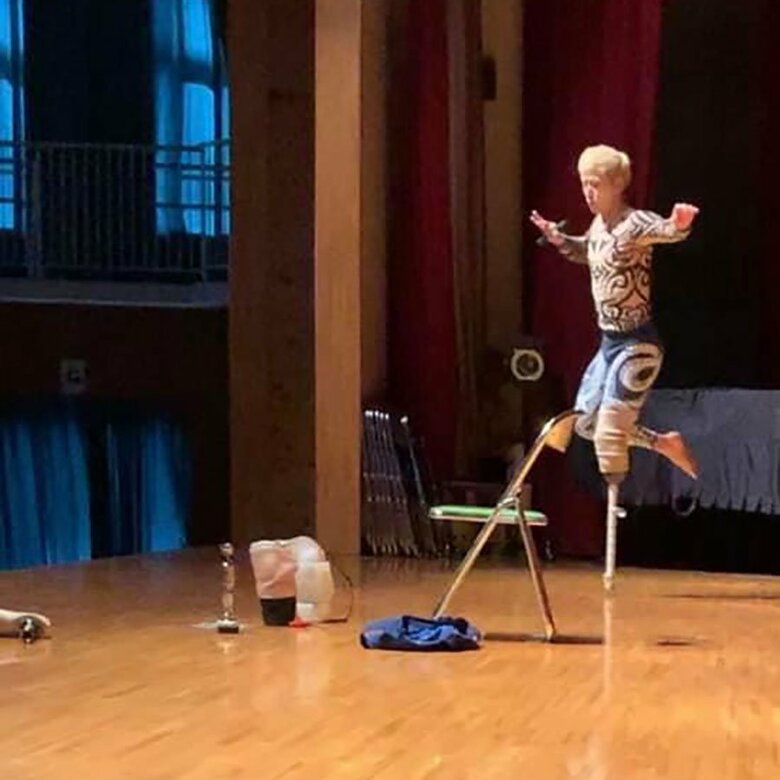 義足を見せてダンスの練習中
