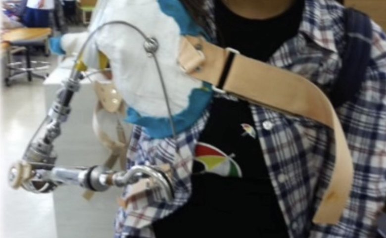 伊藤真波さんの義手