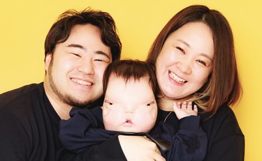 まぶたと頭蓋骨欠損…世界でも前例ない障がいを持った子の母「周りの人に愛してもらえるか」不安を救った夫の「言葉」