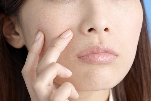 肌荒れに悩む女性の画像