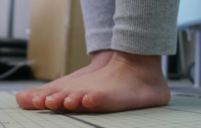 足指が地面につかず浮いている「浮き指」