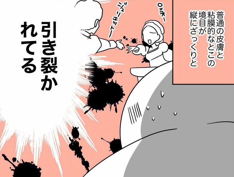 「脱毛しようとして股間が裂けた話」（19/40枚）