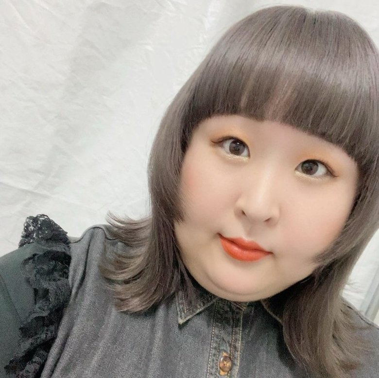 整形後、くっきり二重のかなでさん