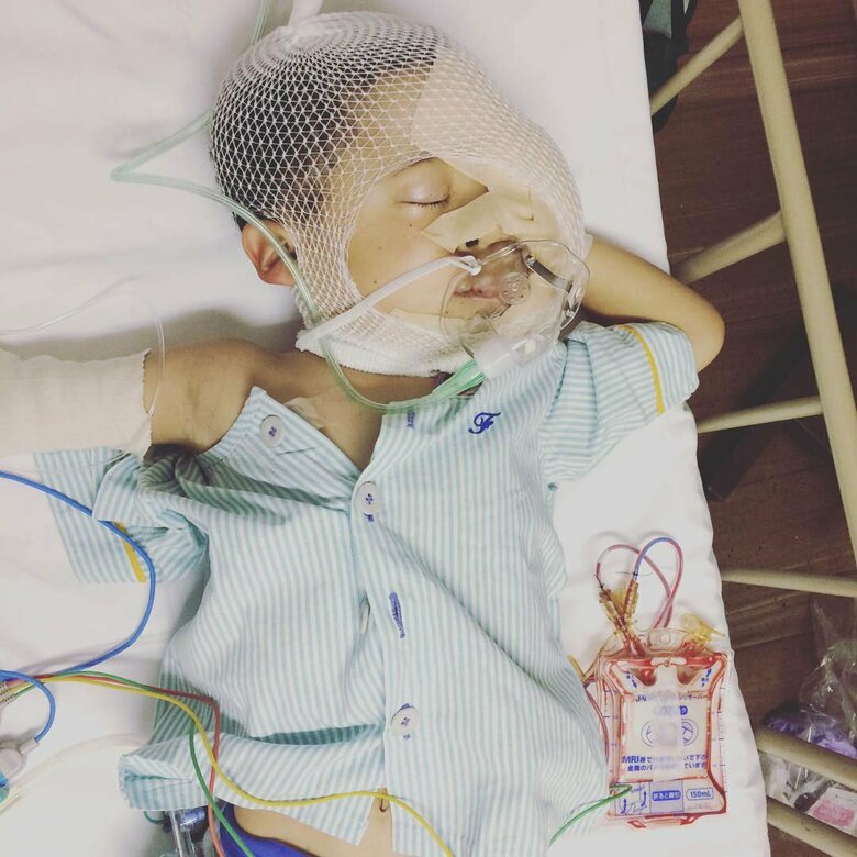 6歳で顔の腫瘍をとる手術をした魂児さん