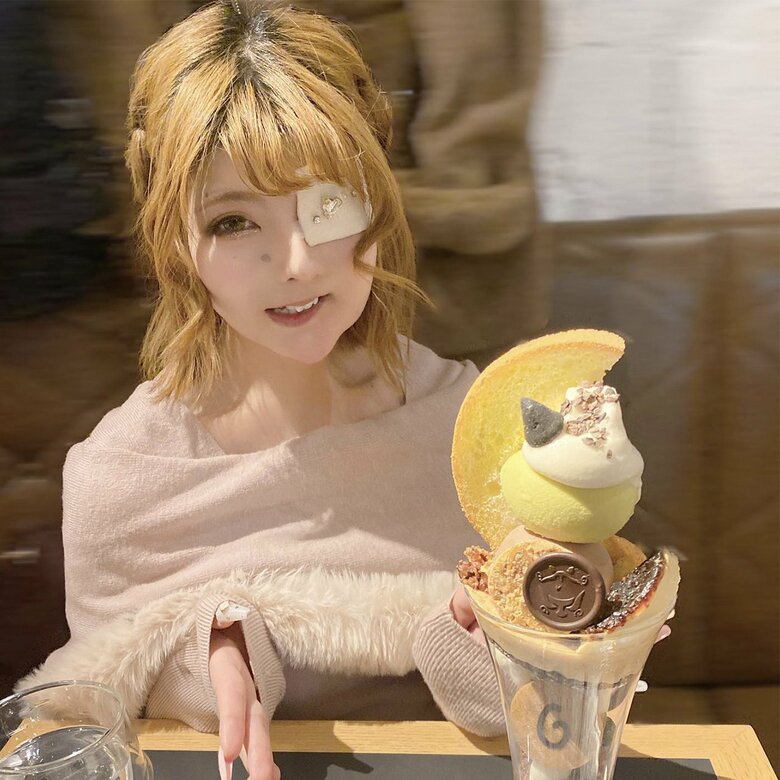 手作りの眼帯をつけるおしゃれなあやかさん