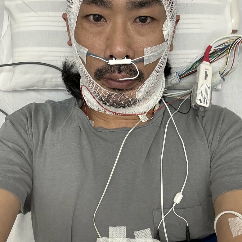 「睡眠時無呼吸症候群」治療中の様子