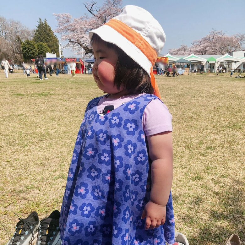 2歳8か月、顔がパンパンでさすがに心配になってきたころ