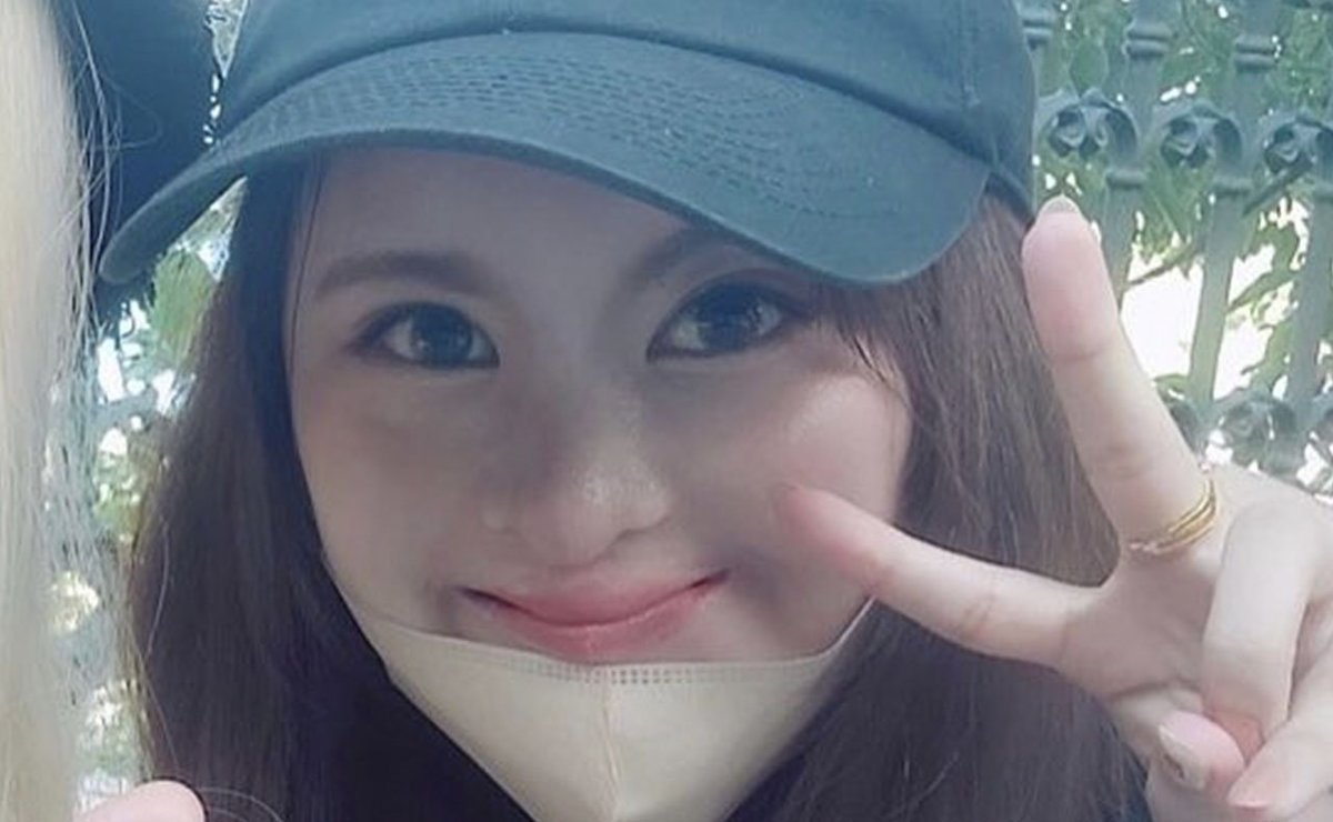 小林えみか 生まれつき唇も鼻も片耳もなく心臓には穴「口唇口蓋裂」の女性が小学校時代に抱えた苦悩「円形脱毛症で学校から連絡が」｜CHANTO WEB