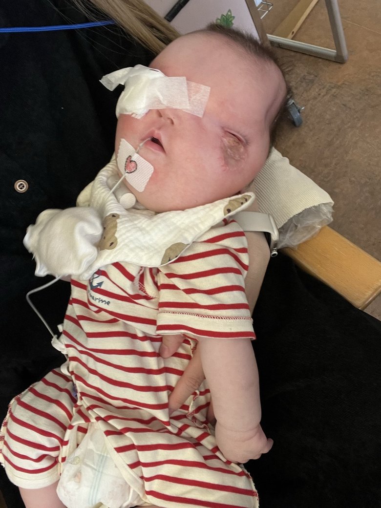 生後3か月。片目のガーゼが取れました