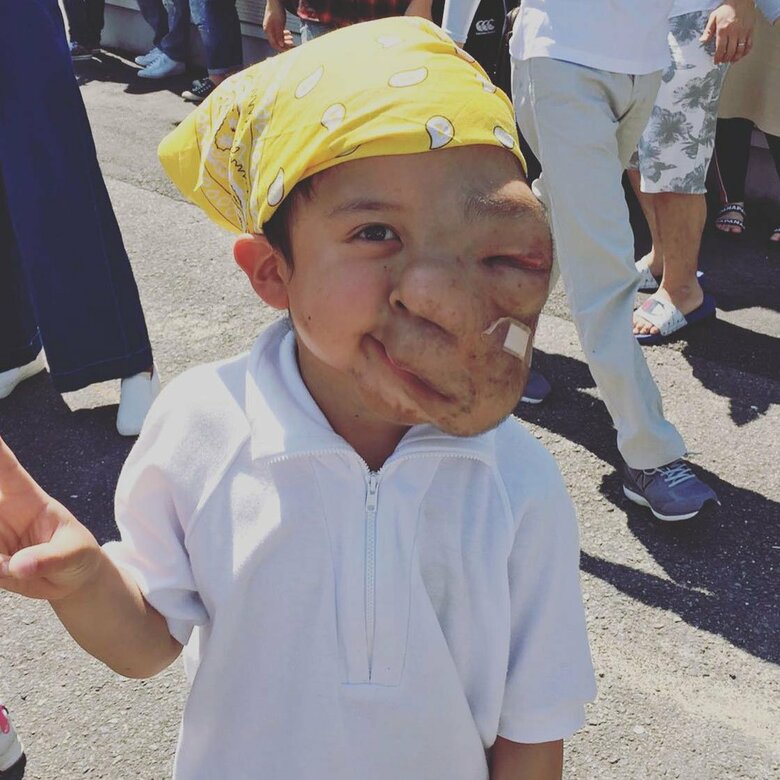 小学3年生の運動会のとき