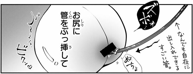 漫画『末期ガンでも元気です　38歳エロ漫画家、大腸ガンになる』第2話（39/54P）