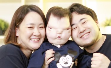 まぶたと頭蓋骨欠損…「お顔に特徴があるなら、見慣れてもらうしかない」とYouTube配信を始めた両親の「覚悟」