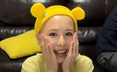 「結婚1年もウィッグを外せずにいた」髪が少ない先天性乏毛症で悩む妻の一大決心に、毎日「かわいい」で応えた夫の愛
