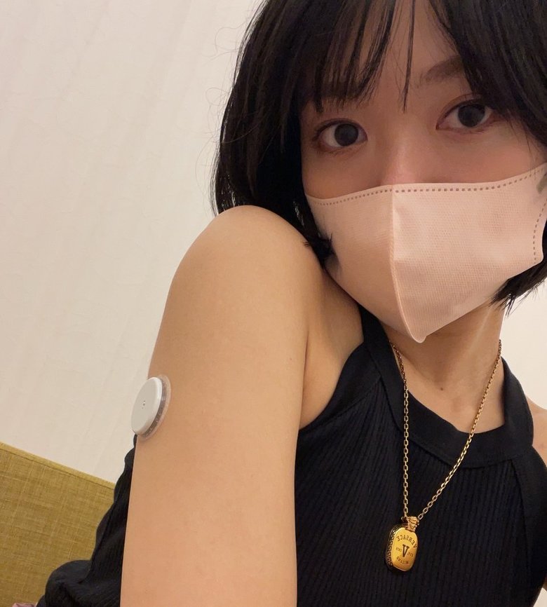 腕に貼ることで血糖値を測定できる「リブレ」を出産直前までつけていた