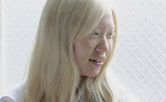 「親戚中で私だけ」アルビノの女性「この子の見た目に触れないで」と家族が学校に配慮求めるも感じた「過ごしづらさ」