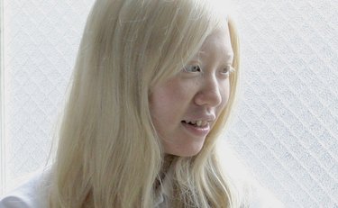 「親戚中で私だけ」アルビノの女性「この子の見た目に触れないで」と家族が学校に配慮求めるも感じた「過ごしづらさ」