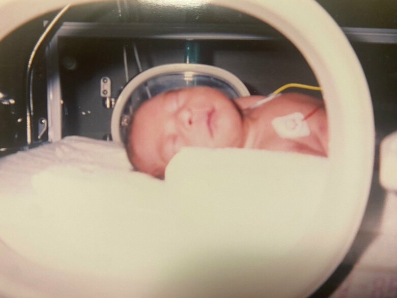 生まれてまもないころ。保育器の中の亮夏さん