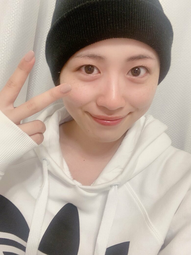 抗がん剤治療で髪の毛が抜けてしまった