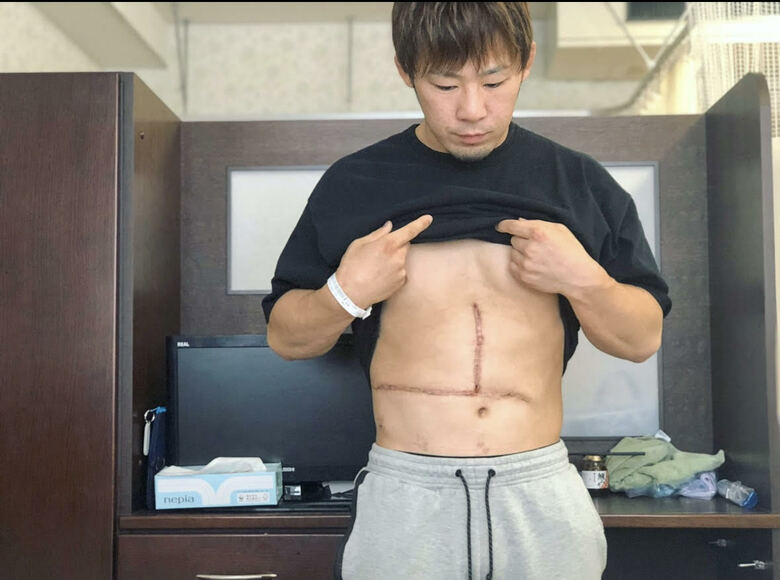 痛々しい手術のあと