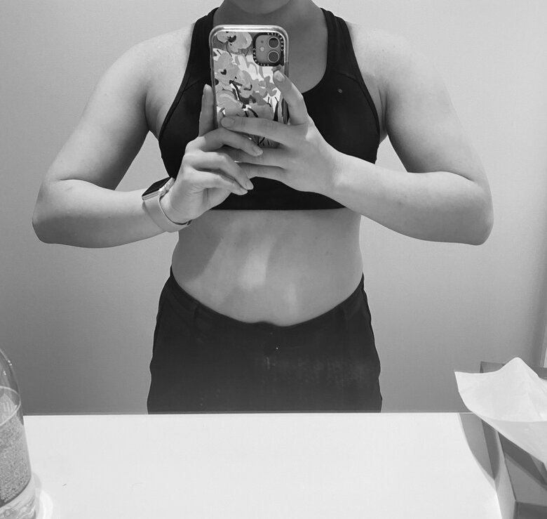 摂食障害で過食続きだったころのムチムチボディ